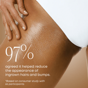 Ingrown Oil – Vanilla Coconut